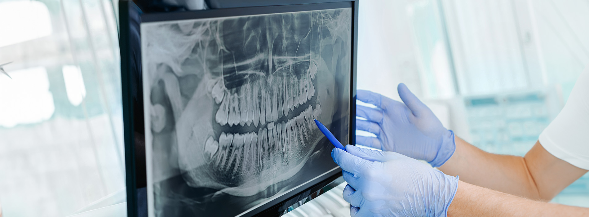 Celebrity Smiles | Sleep Apnea, Dermal Fillers and Periodontal Treatment