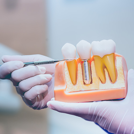 Celebrity Smiles | Dental Bridges, Dental Bonding and Oral Exams