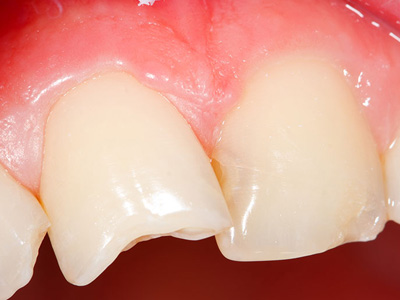 Celebrity Smiles | Oral Exams, Ceramic Crowns and Emergency Treatment