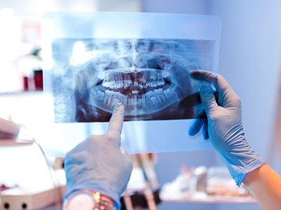 Celebrity Smiles | Sleep Apnea, Dermal Fillers and Periodontal Treatment